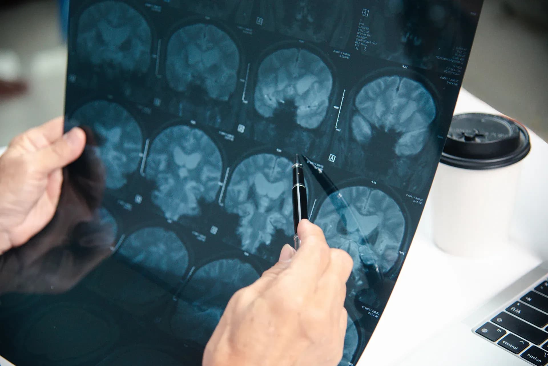 Common Symptoms Of A Traumatic Brain Injury Common Symptoms Of A Traumatic Brain Injury