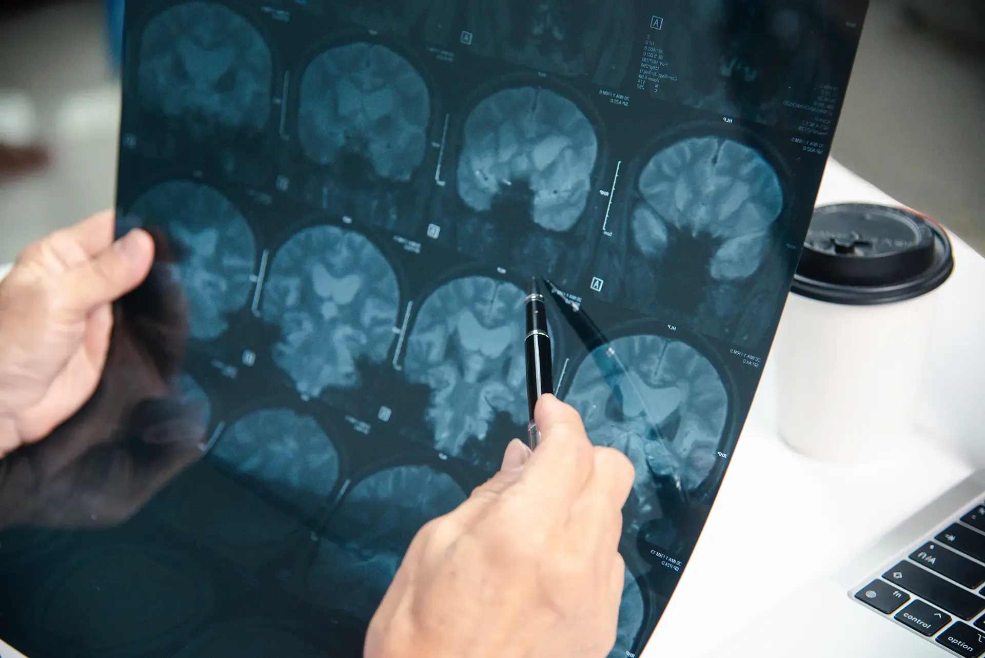 What Types Of Damages Are Common In Traumatic Brain Injury Cases What Types Of Damages Are Common In Traumatic Brain Injury Cases