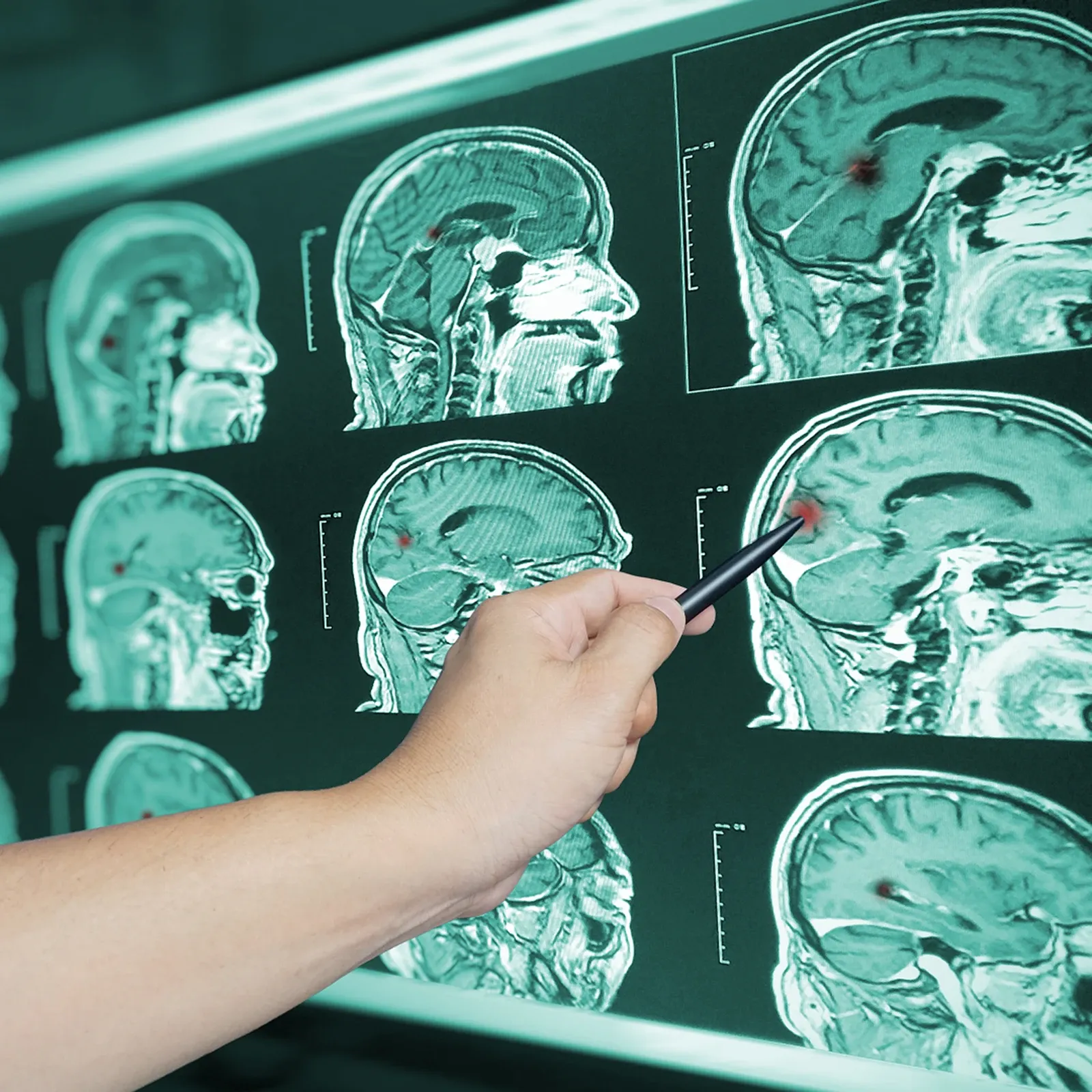 personal-injury-practice-area-serious-injury-traumatic-brain-injury-02 personal-injury-practice-area-serious-injury-traumatic-brain-injury-02